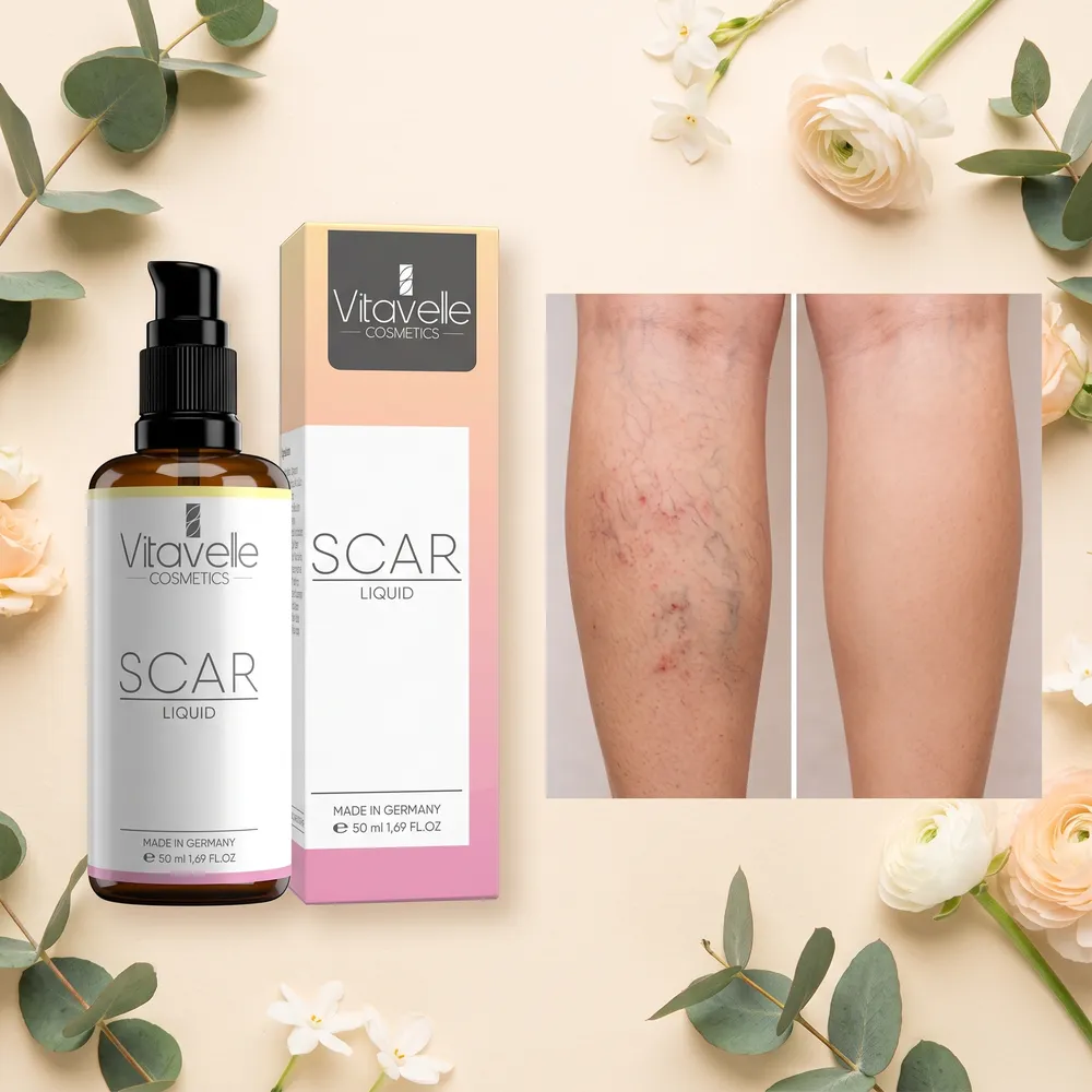 Scar Liquid von Vitavelle mit Vorher-Nachher-Vergleich einer Wade